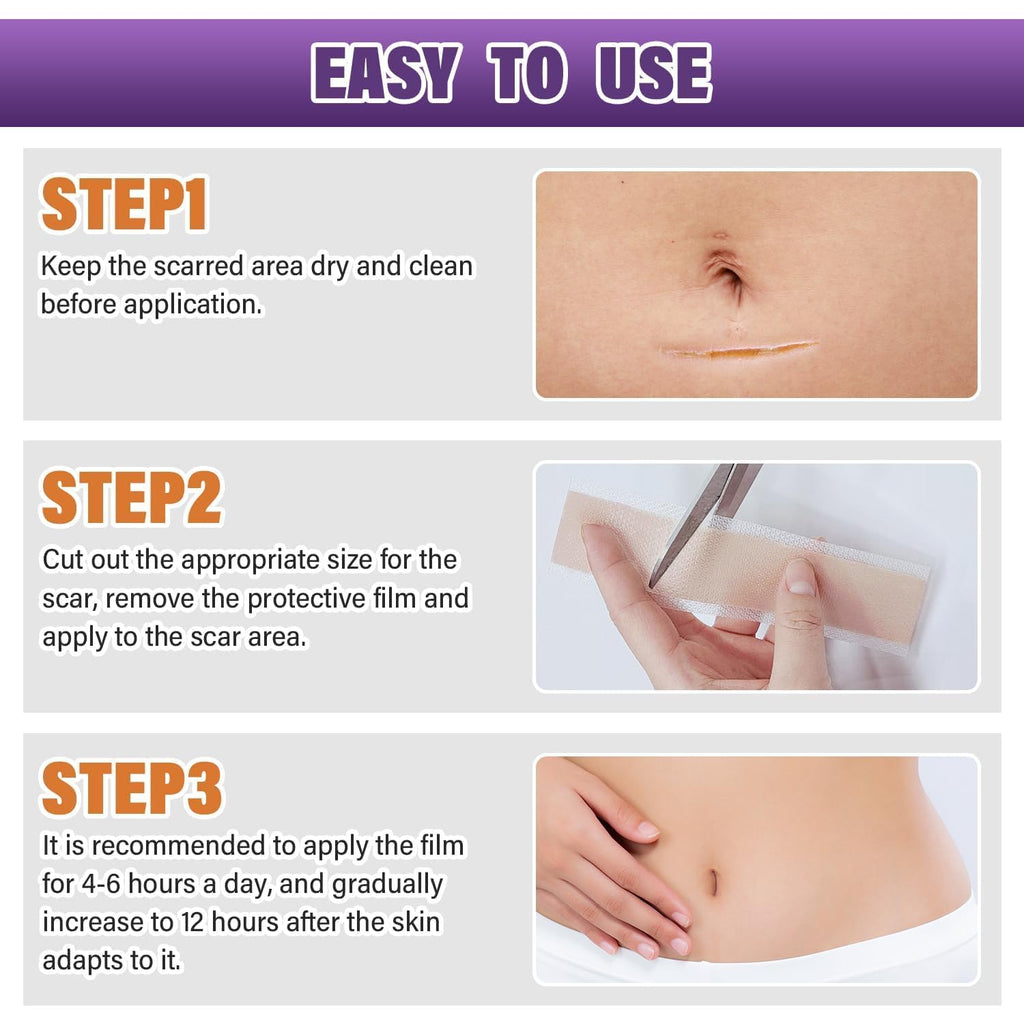 Silicone Scar Sheets,Silicone Scar Tape,Silicone Scar Removal Strips for Surgical,C-Section,Tummy Tuck,Keloid Scars (1.6"X 59" Roll-1.5M) Keloid Bump Removal