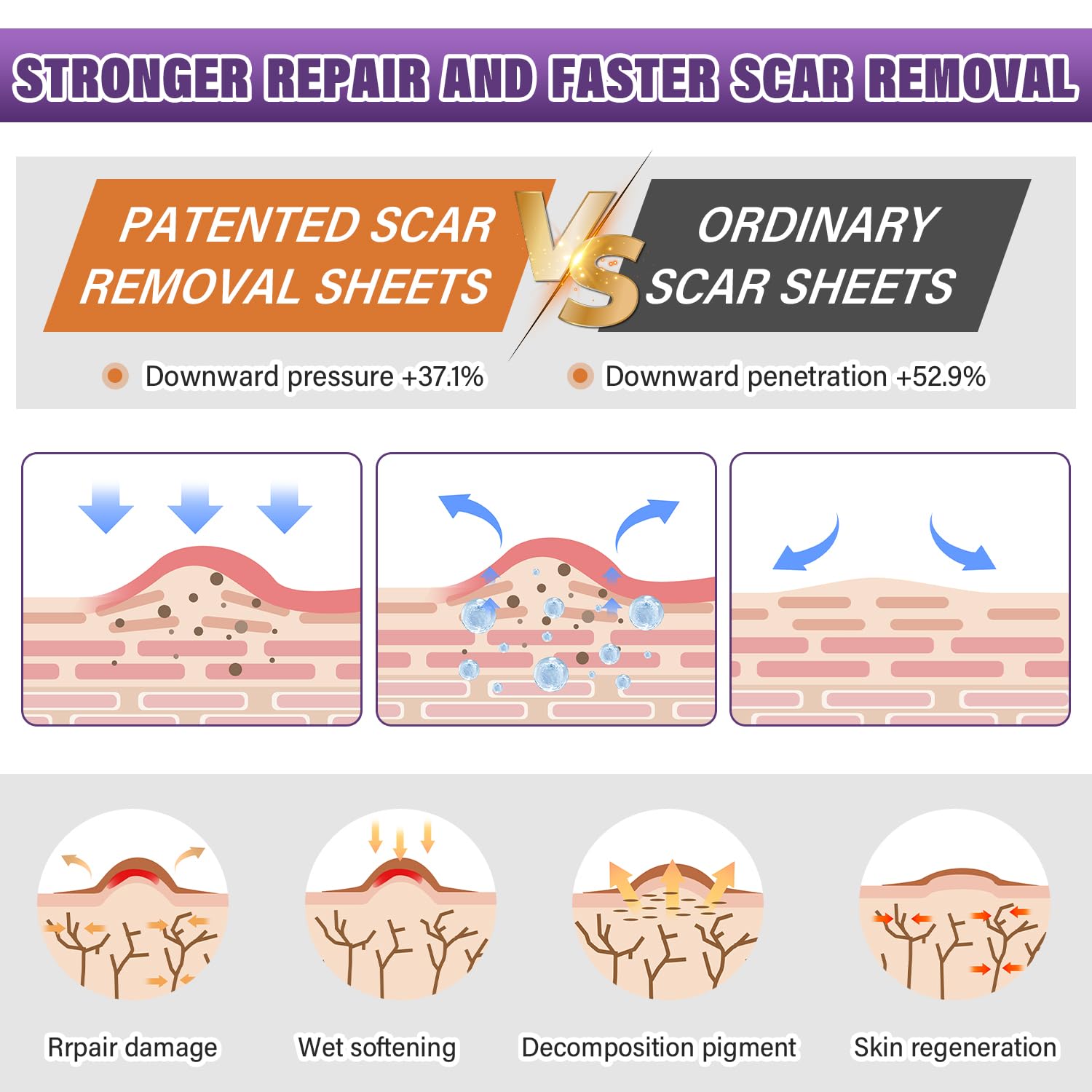 Silicone Scar Sheets,Silicone Scar Tape,Silicone Scar Removal Strips for Surgical,C-Section,Tummy Tuck,Keloid Scars (1.6"X 59" Roll-1.5M) Keloid Bump Removal