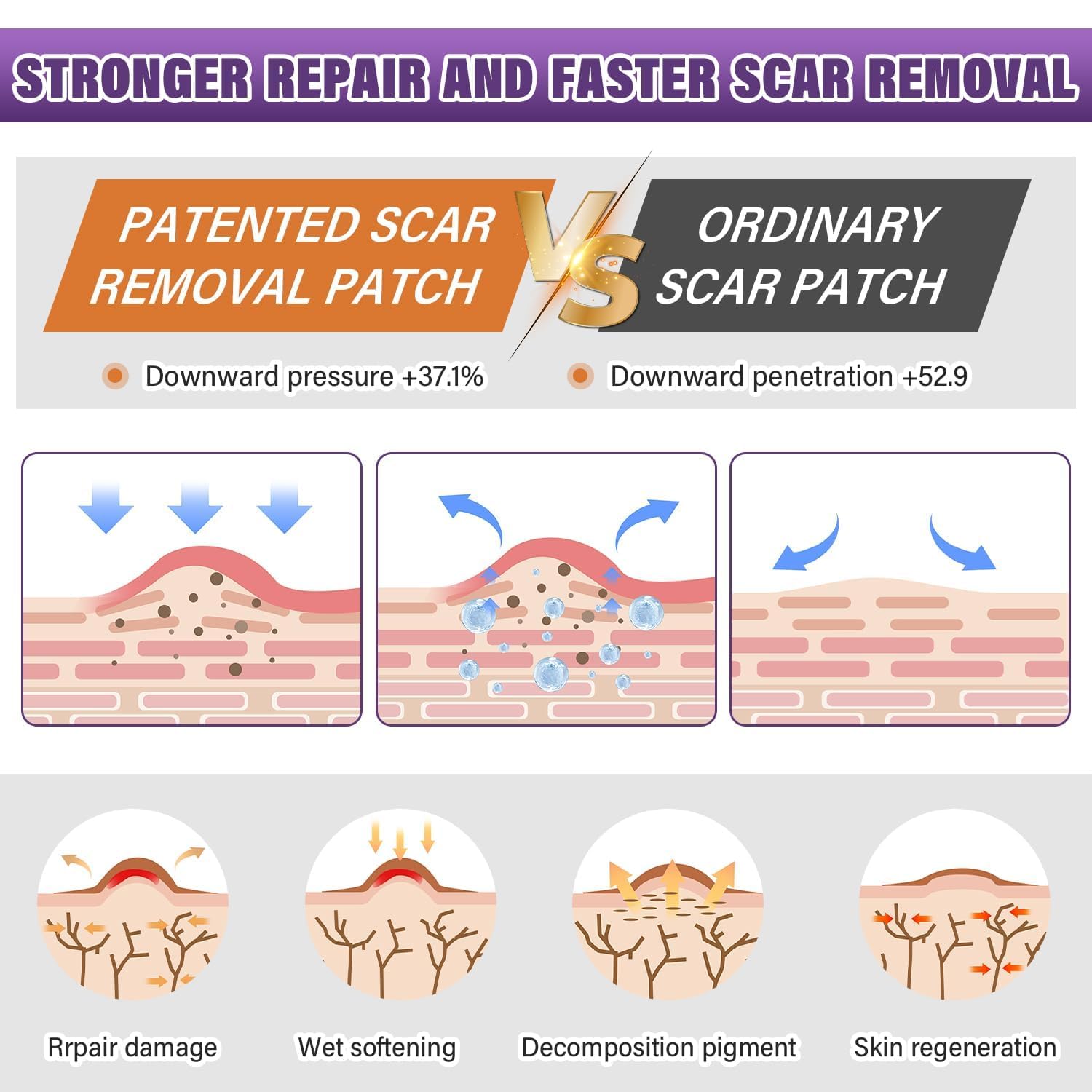 Silicone Scar Sheets,Silicone Scar Tape,Silicone Scar Removal Strips for Surgical,C-Section,Tummy Tuck,Keloid Scars (1.6"X 59" Roll-1.5M) Keloid Bump Removal